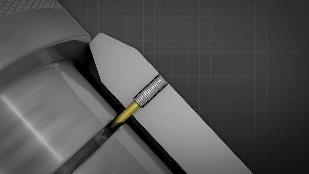 Close up of the BiSN bulk head screw